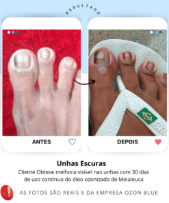Óleo de Melaleuca Ozonizado - Imagem 6