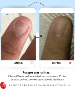 Óleo de Melaleuca Ozonizado - Imagem 5