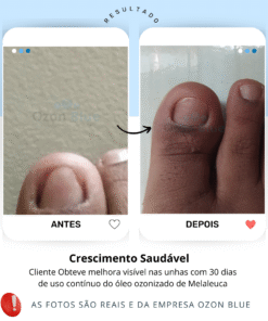 Óleo de Melaleuca Ozonizado - Imagem 3