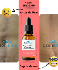 Óleo de Rosa Mosqueta Ozonizado - Imagem 10