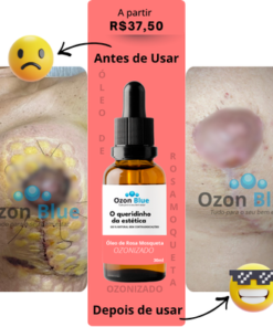 Óleo de Rosa Mosqueta Ozonizado - Imagem 7