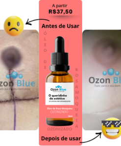 Óleo de Rosa Mosqueta Ozonizado - Imagem 3