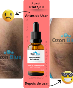 Óleo de Rosa Mosqueta Ozonizado