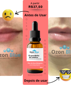 Óleo de Rosa Mosqueta Ozonizado - Imagem 8