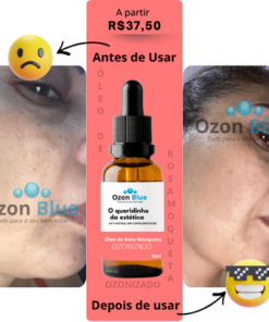 Óleo de Rosa Mosqueta Ozonizado - Imagem 4