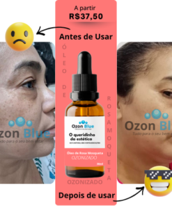 Óleo de Rosa Mosqueta Ozonizado - Imagem 6