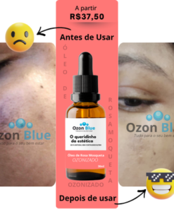 Óleo de Rosa Mosqueta Ozonizado - Imagem 9