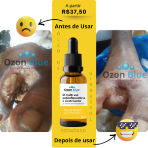 Óleo de Girassol Ozonizado