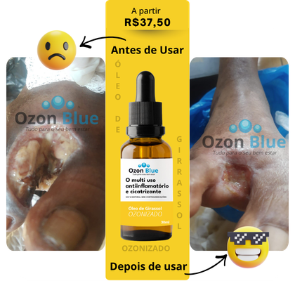 Óleo de Girassol Ozonizado