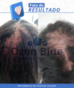 Alternative view of Shampoo