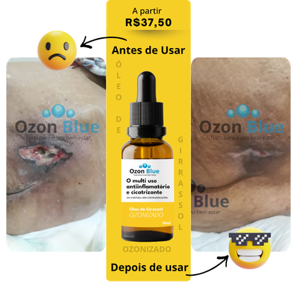 Óleo de Girassol Ozonizado - Imagem 4